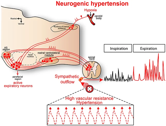 Scientists discover new cause of high blood pressure, treatment pathway 1 Hypertension diagram